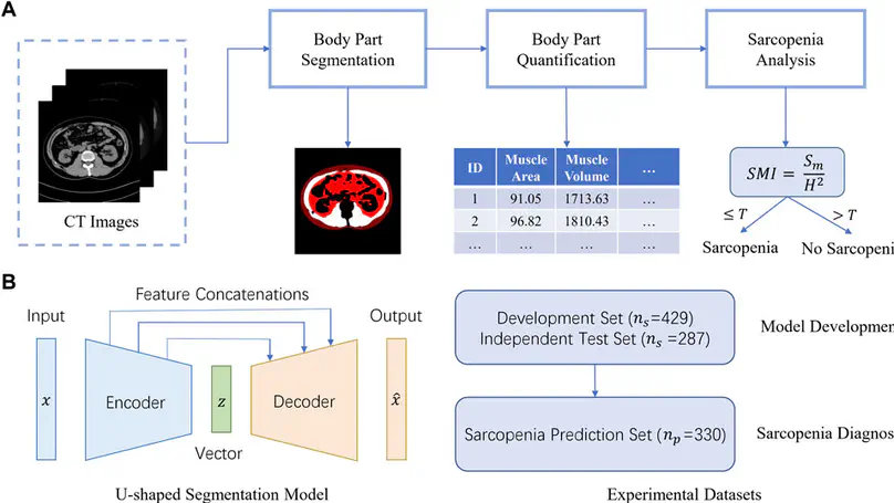 Our paper "Detection of sarcopenia using deep learning-based artificial intelligence body part measure system (AIBMS)" is accepted by Frontiers in Physiology.