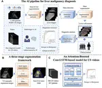 Improving artificial intelligence pipeline for liver malignancy diagnosis using ultrasound images and video frames